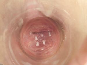 Внутренности влагалища крупным планом или путешествие к матке