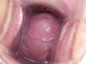 Развратница вставила в манду расширитель и показывает вагину