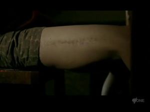 Девушка со шрамом доводит себя до оргазма