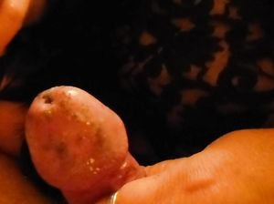 Больная телка прижигает член раба сигаретой