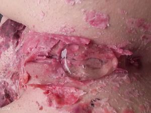 Девка-лесбиянка издевается, заливая свечку в пизду